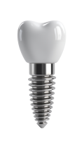 —Pngtree—dental implant illustration showing a_19834561